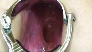 Elmer dansk amatør sex film ' s hustru ekstrem speclum - anal!- kak1